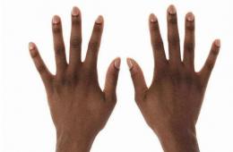 【让罕见被看见·壹】患上这种病，人体各处器官会逐渐硬化